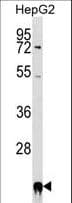 Polyclonal Rabbit anti-Human PPIF / Cyclophilin F Antibody (aa103-131, WB)