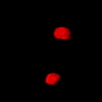 SETD5 Antibody
