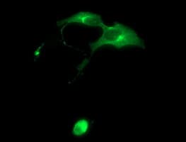 SYP / Synaptophysin Antibody (clone OTI2A10)