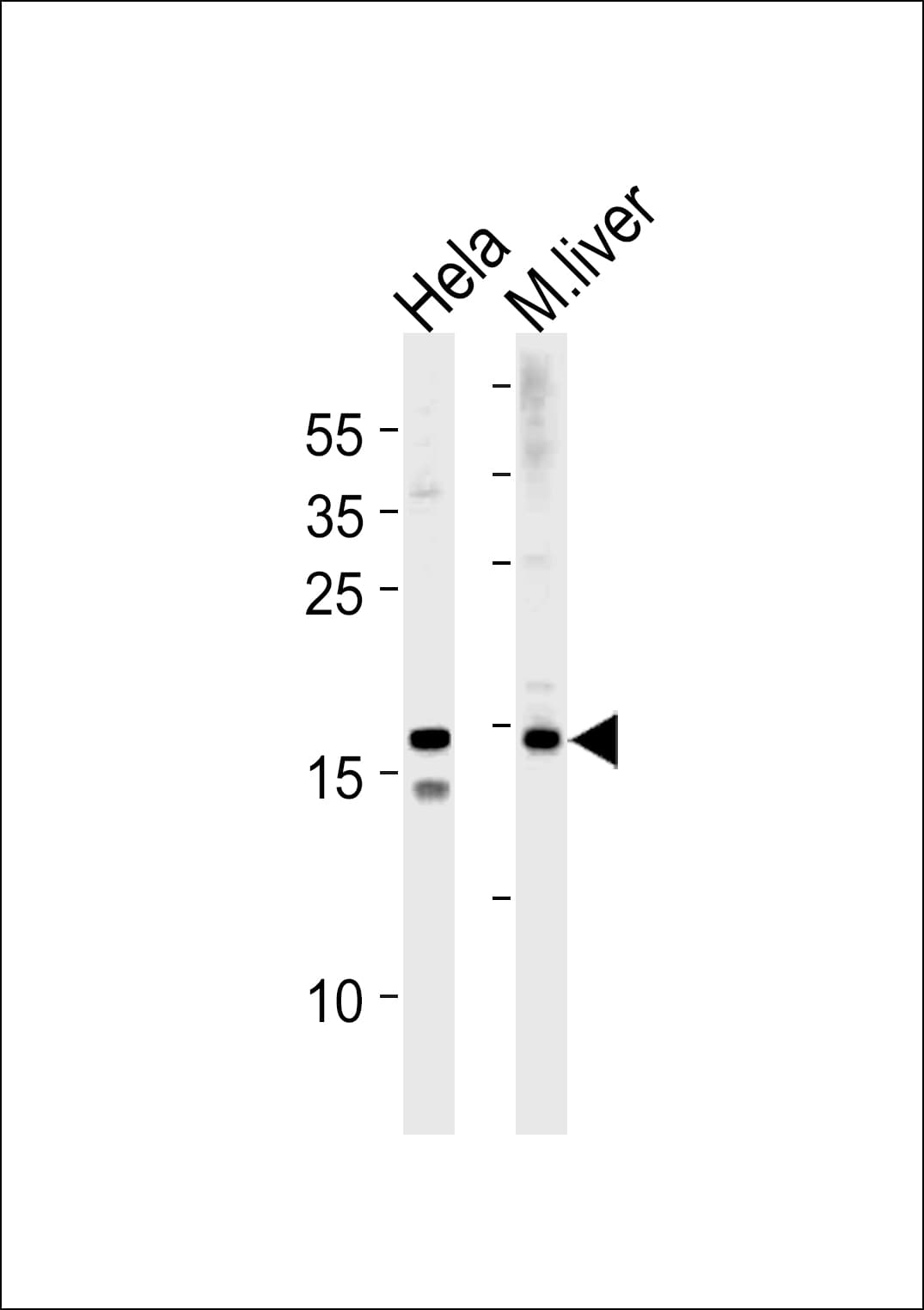 IHC-plus™ SUMO2 + SUMO3 Antibody (aa49-81)
