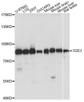 G2E3 / KIAA1333 Antibody