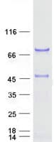 Human SCHIP1 Protein (Recombinant Myc-DDK (Flag))