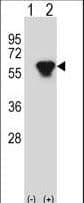 Polyclonal Rabbit anti-Human PRKAR2B Antibody (aa119-147, WB)