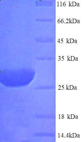 Rat DIO2 Protein (Recombinant His)