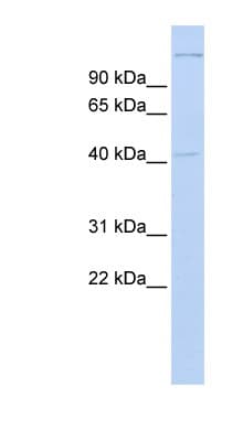 Polyclonal Rabbit anti-Human AMID / AIFM2 Antibody (C-Terminus, IHC, WB)