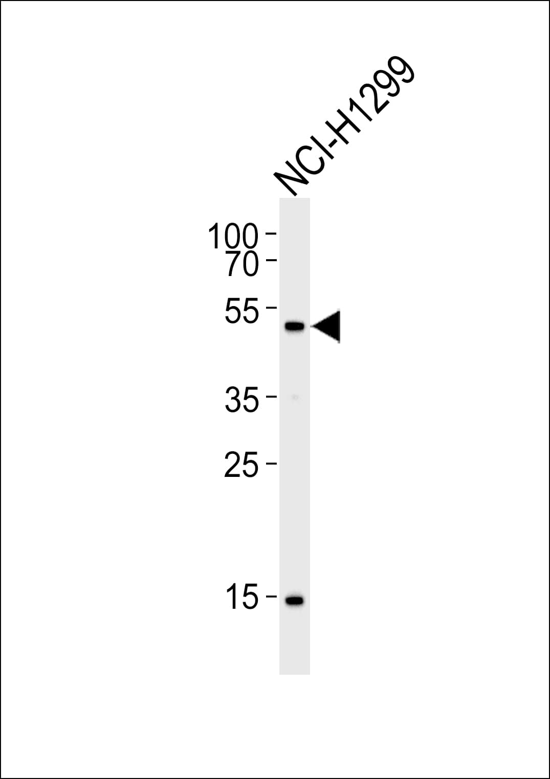 STK11 / LKB1 Antibody (aa393-420)