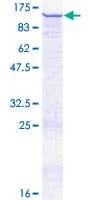 Human ZNF606 Protein (Recombinant GST)