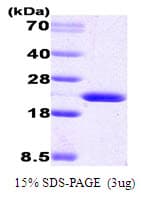 Human PPIB / Cyclophilin B Protein (Recombinant)