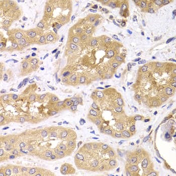 RPS4X + RPS4Y1 + RPS Antibody