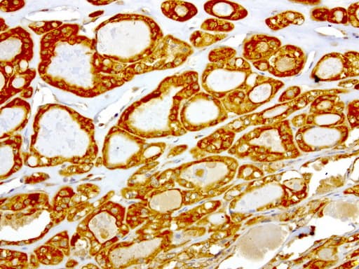 NME1 / NM23 Antibody (clone UMAB94)