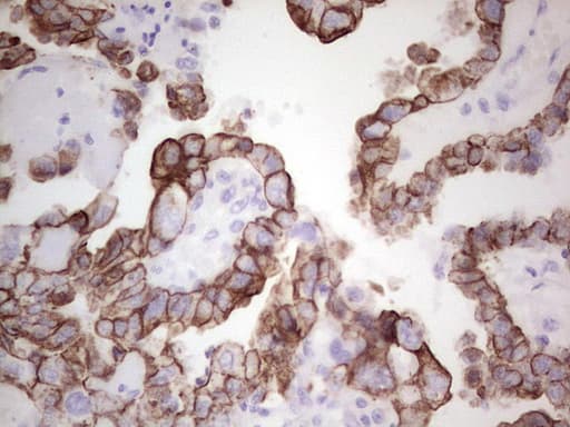 Monoclonal Mouse anti-Human Acidic Cytokeratin AE1 Antibody (clone AE1, IHC)