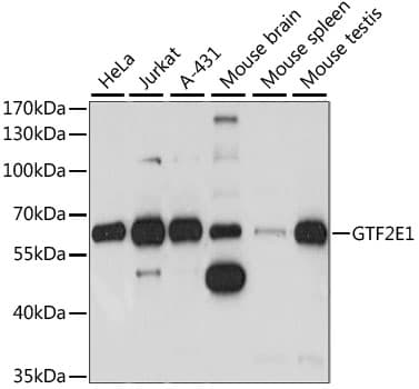 Polyclonal Rabbit anti-Human GTF2E1 Antibody (WB)