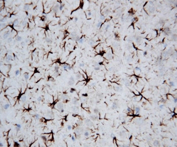 GFAP Antibody (aa417-432)