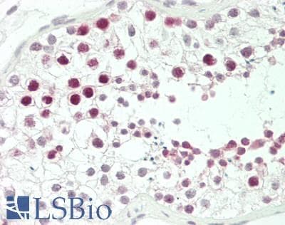 IHC-plus™ Polyclonal Rabbit anti-Human KDM7A / JHDM1D Antibody (aa290-316, IHC, WB)