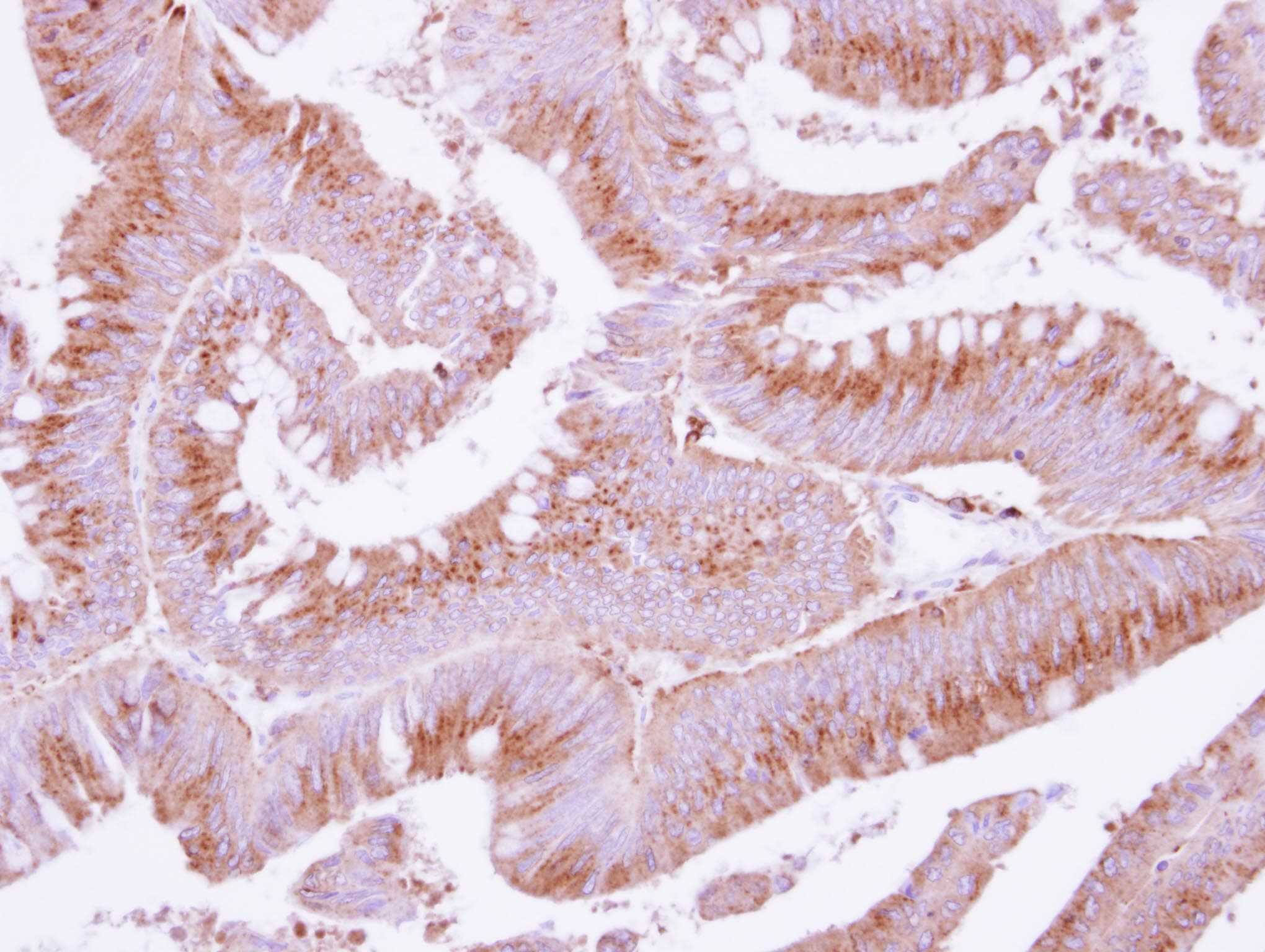 COX15 Antibody