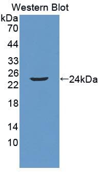 LCN2 / Lipocalin 2 / NGAL Antibody (aa23-199, Biotin)