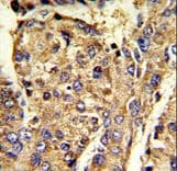 HNRNPL / hnRNP L Antibody (aa461-490)
