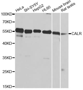 Polyclonal Rabbit anti-Human CALR / Calreticulin Antibody (IHC, IF, WB)