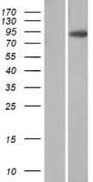 VIL1 / Villin Protein (Over-Expression Lysate Myc-DDK (Flag))