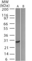 USP5 Antibody (aa204-217)