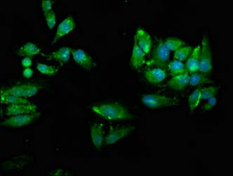 UBE2N / UBC13 Antibody