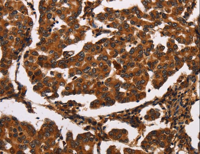 ARSB / Arylsulfatase B Antibody (aa193-205)