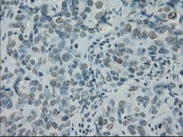 Monoclonal Mouse anti-Human PRKY Antibody (clone OTI5E9, Carrier-free, IHC, IF, WB)
