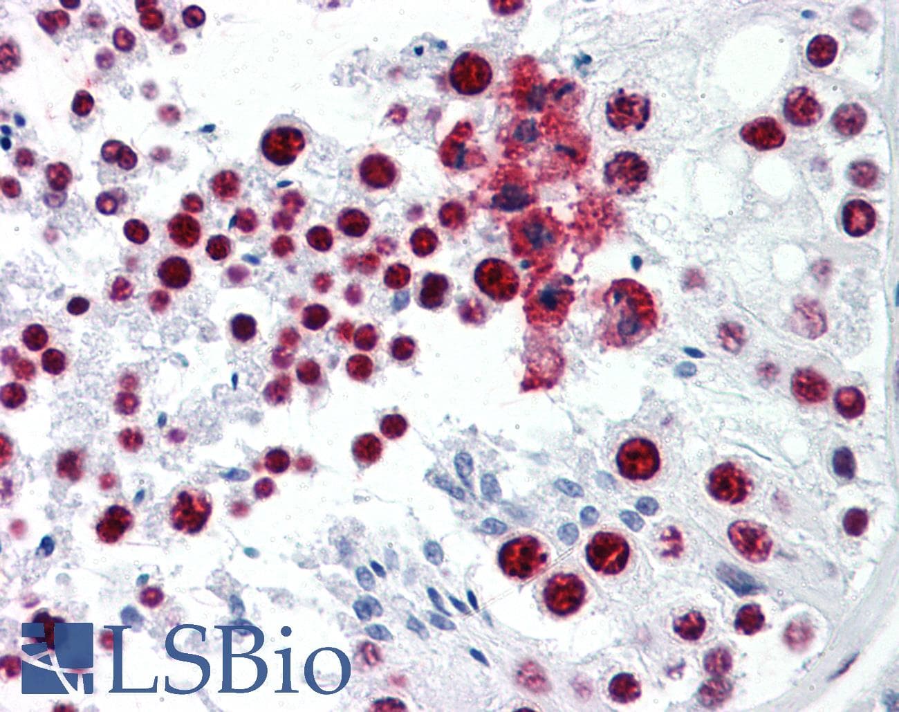 IHC-plus™ Monoclonal Mouse anti-Human CDKL1 Antibody (clone 2H6, IHC, WB)