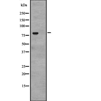 CACNB4 Antibody