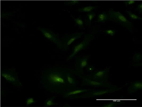 ER Alpha / Estrogen Receptor Antibody (clone 2F8)