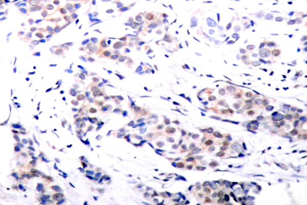 ELK1 Antibody (His377)