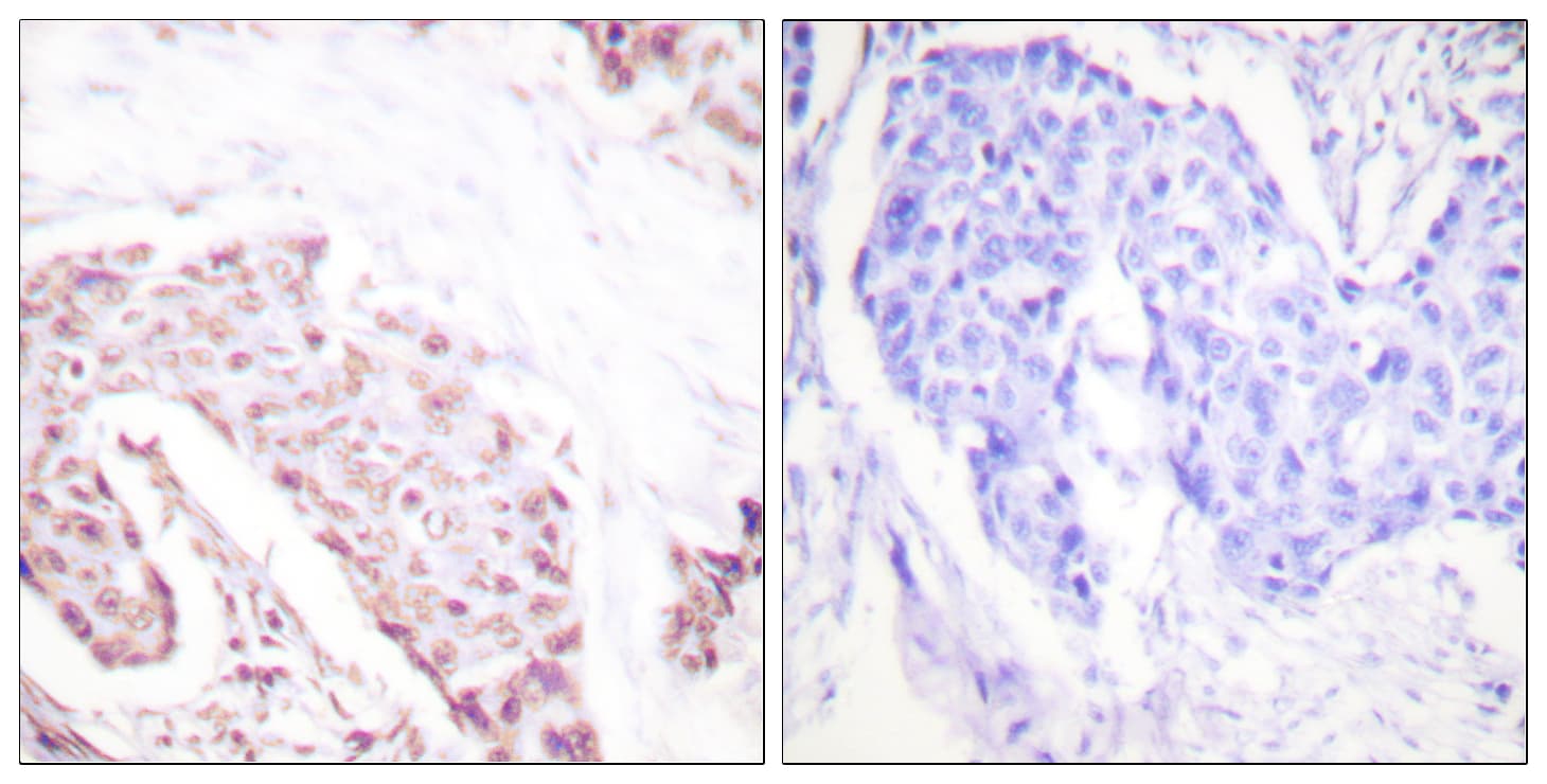 Polyclonal Rabbit anti-Human AKT1 Antibody (phospho-Ser124, IHC, WB)