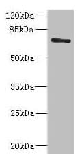Polyclonal Rabbit anti-Human ZNF549 Antibody (IHC, WB)
