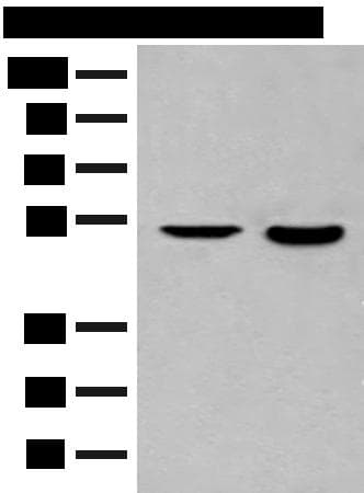 IL7R / CD127 Antibody