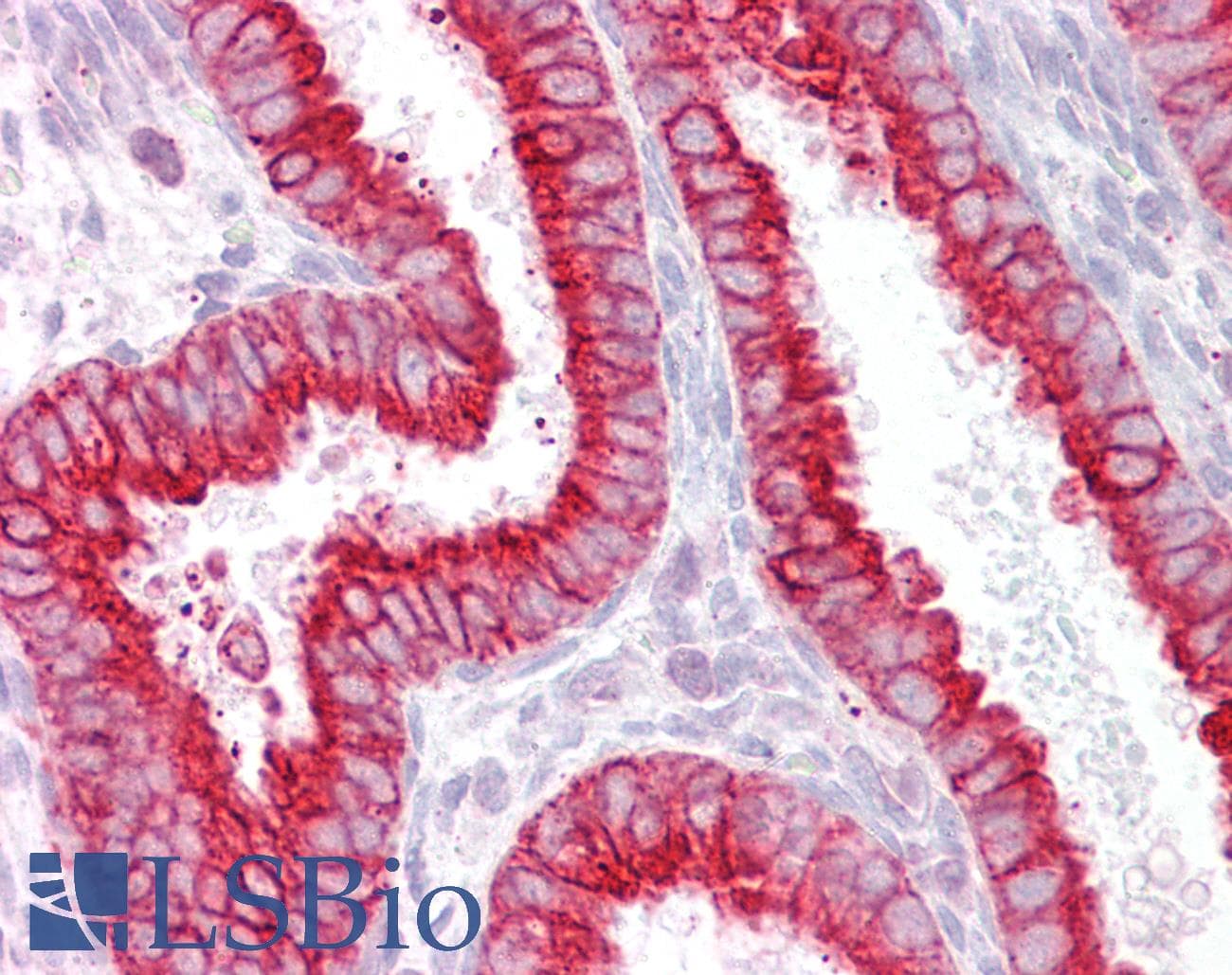 IHC-plus™ Polyclonal Goat anti-Human CHRNB4 Antibody (aa87-101, IHC)