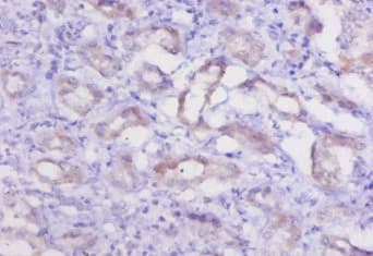 CTSK / Cathepsin K Antibody