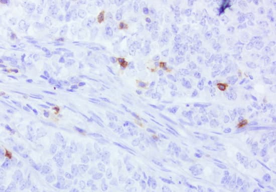 Monoclonal Mouse anti-Human PDCD1 / CD279 / PD-1 Antibody (clone UMAB199, IHC, IF, WB)