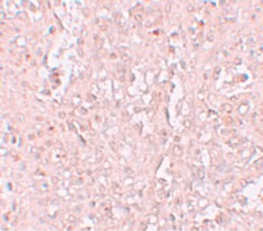 Polyclonal Rabbit anti-Human SLC39A13 / ZIP13 Antibody (IHC, IF, WB)