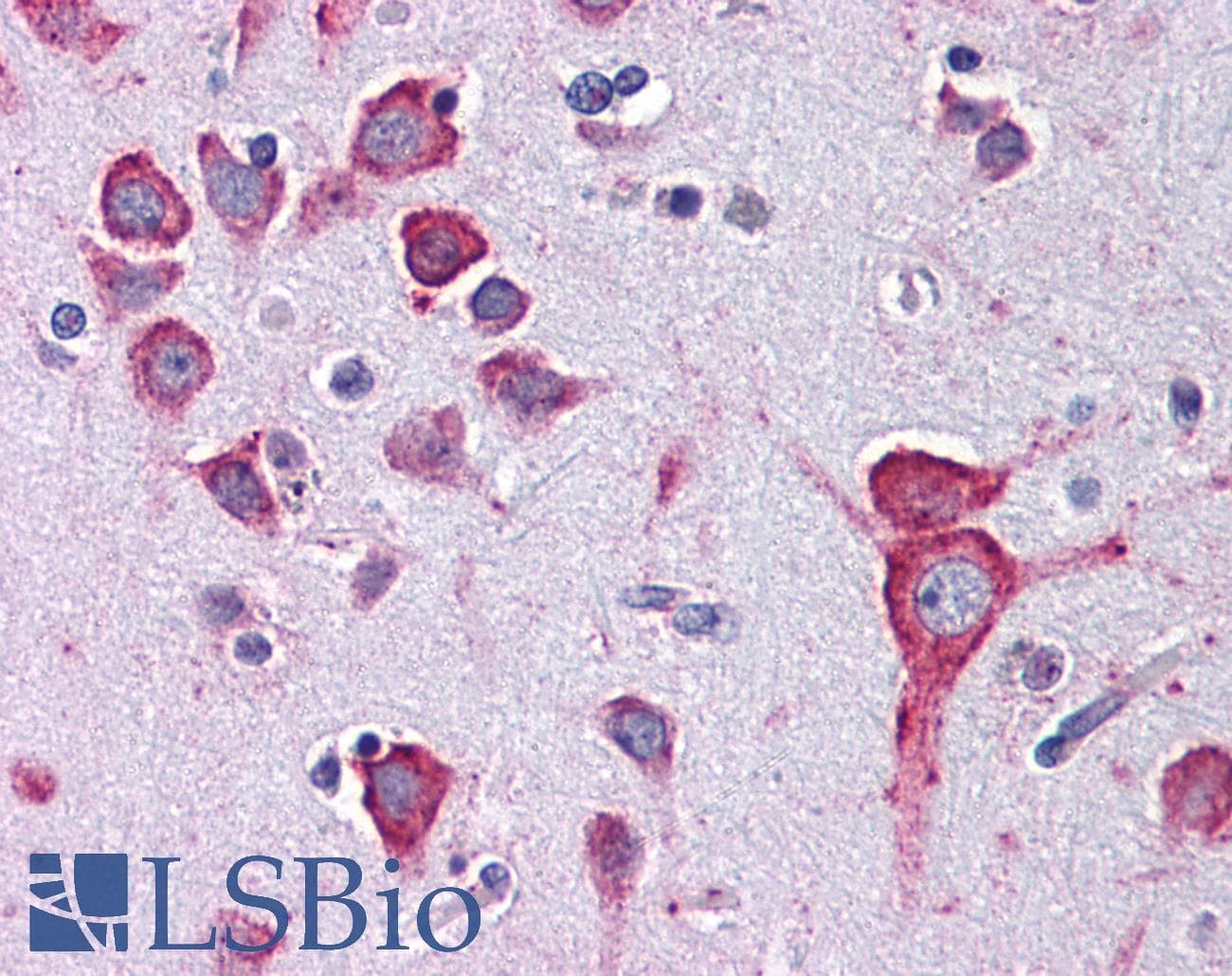 PathPlus™ HTR1A / 5-HT1A Receptor Antibody (clone 19A9.2)