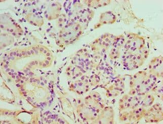 Polyclonal Rabbit anti-Human BANP Antibody (aa1-260, IHC, WB)