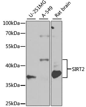 SIRT2 / Sirtuin 2 Antibody