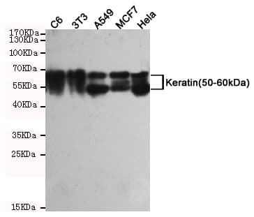 KRT5 / CK5 / Cytokeratin 5 Antibody