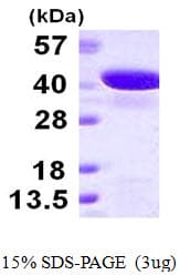 Human GIPC2 Protein (Recombinant His)