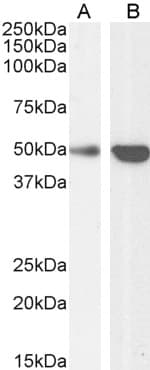 IHC-plus™ TRAF2 Antibody (aa529-540)