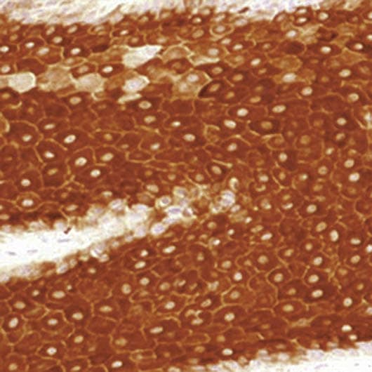 KRT16 / CK16 / Cytokeratin 16 Antibody (C-Terminus, clone LL025)
