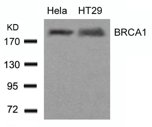 IHC-plus™ Polyclonal Rabbit anti-Human BRCA1 Antibody (Ser1423, IHC, WB)
