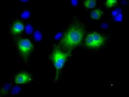 RDH11 Antibody (clone OTI1B4)