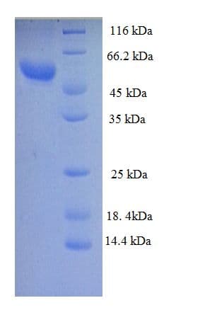 Human ZP3 Protein (Recombinant GST)