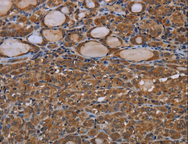 Polyclonal Rabbit anti-Human GJB4 / CX30.3 / Connexin 30.3 Antibody (IHC, WB)