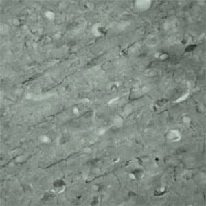 Polyclonal Rabbit anti-Human SYT17 Antibody (Internal, IHC, WB)